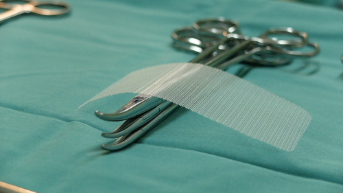 Seeking Justice for Los Angeles Hernia Mesh Injuries? Here's Everything You Need to Know