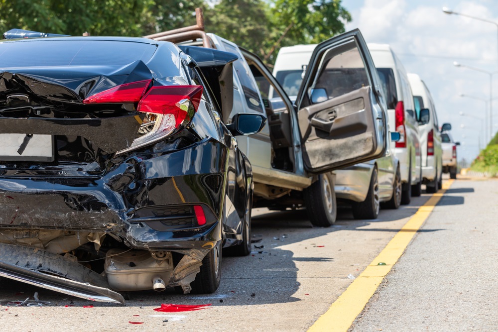 Best car accident attorney in Ventura